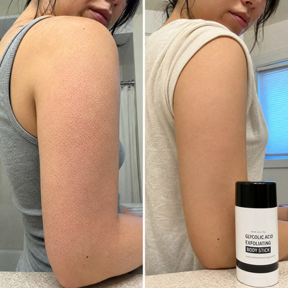 Avolei Bare Glycolic Acid For KP