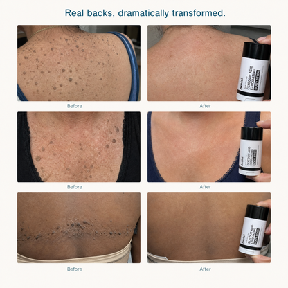 Avolei Bare Glycolic Acid For Body SK