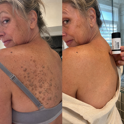 Avolei Bare Glycolic Acid For Body SK
