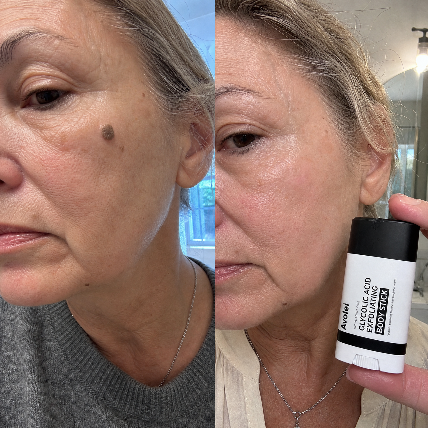 Avolei Bare Glycolic Acid For Facial SK