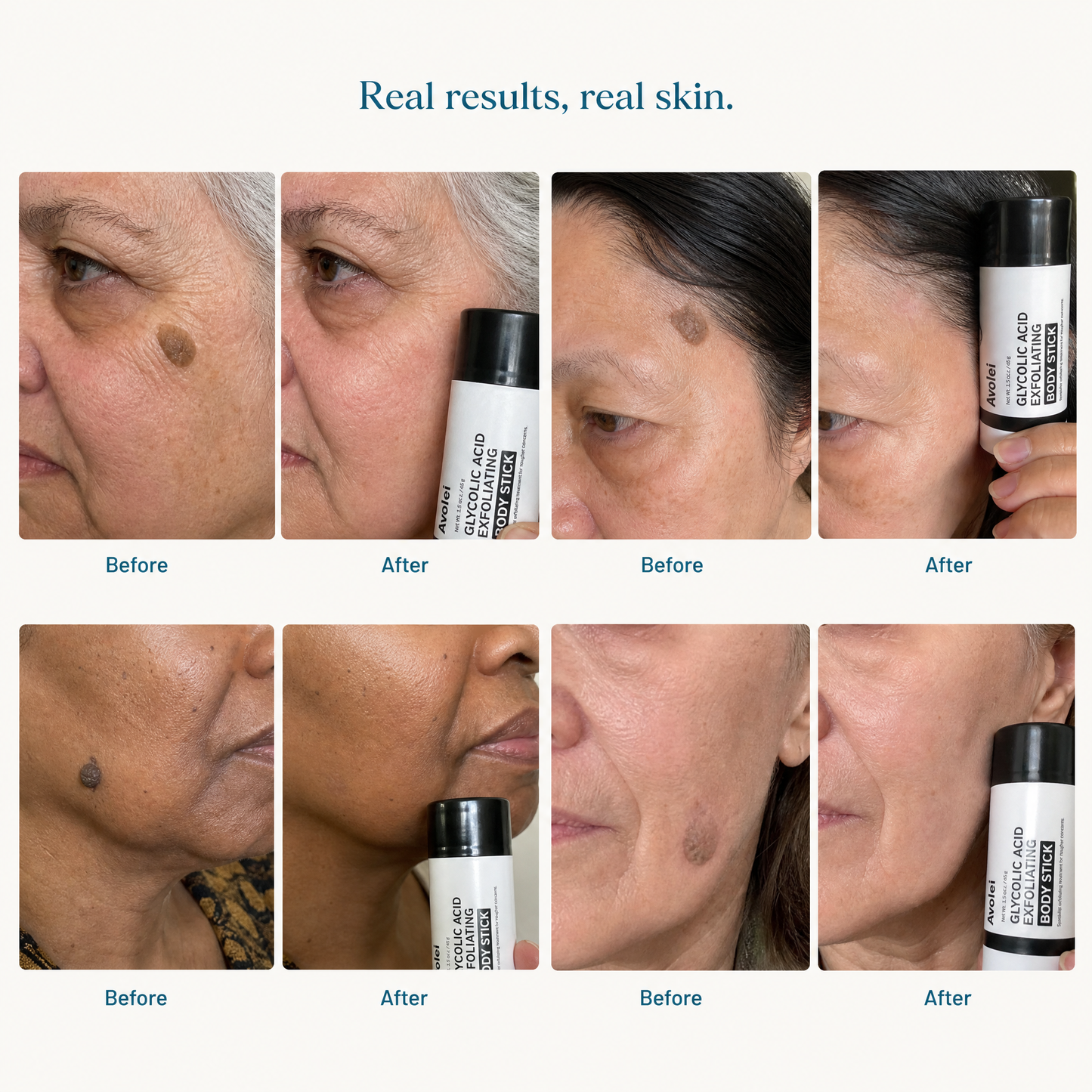 Avolei Bare Glycolic Acid For Facial SK