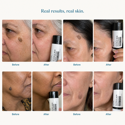 Avolei Bare Glycolic Acid For Facial SK