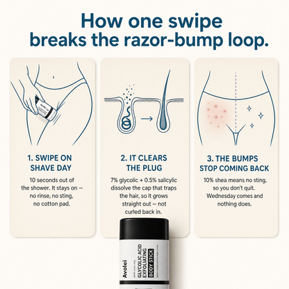 Avolei Bare Glycolic Acid For Ingrowns